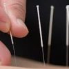 New Zealand School Of Acupuncture And Traditional Chinese Medicine (NZSATCM)