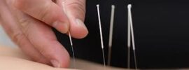 New Zealand School Of Acupuncture And Traditional Chinese Medicine (NZSATCM)